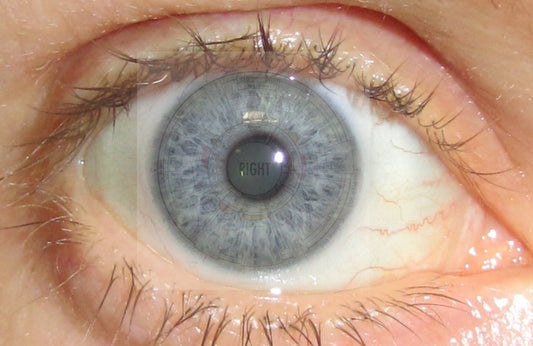 Iridology Consultation - Bush Healing Centre